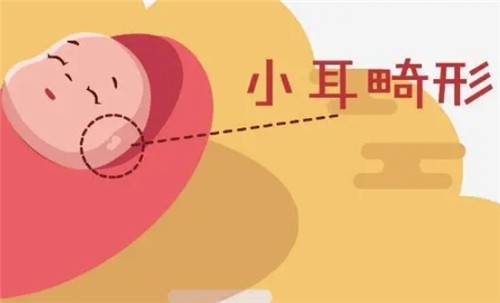 【河南中醫(yī)藥大學一附院】莊洪興教授暑假坐診，耳畸形修復限時預約！