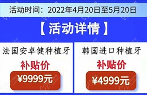進(jìn)口種植牙可享實惠補貼價