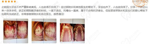 郭淑蘋(píng)醫(yī)生口碑評(píng)價(jià)