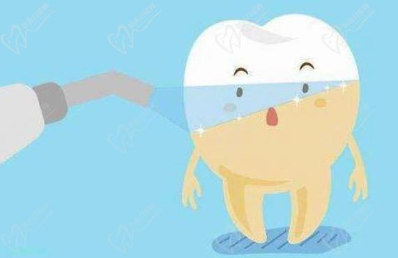 viva冷光美白是國(guó)產(chǎn)的嗎？