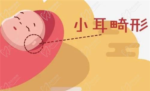 什么是耳畸形？哪些情況需要治療？