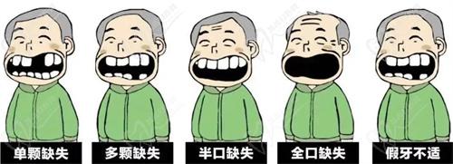 杭州種植牙哪家醫(yī)院好？