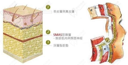 丁昆琨醫(yī)生拉皮手術(shù)技術(shù)特色